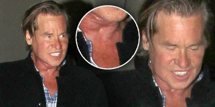 Val Kilmer Masks Mystery Ailment, but Just Draws More Intrigue
