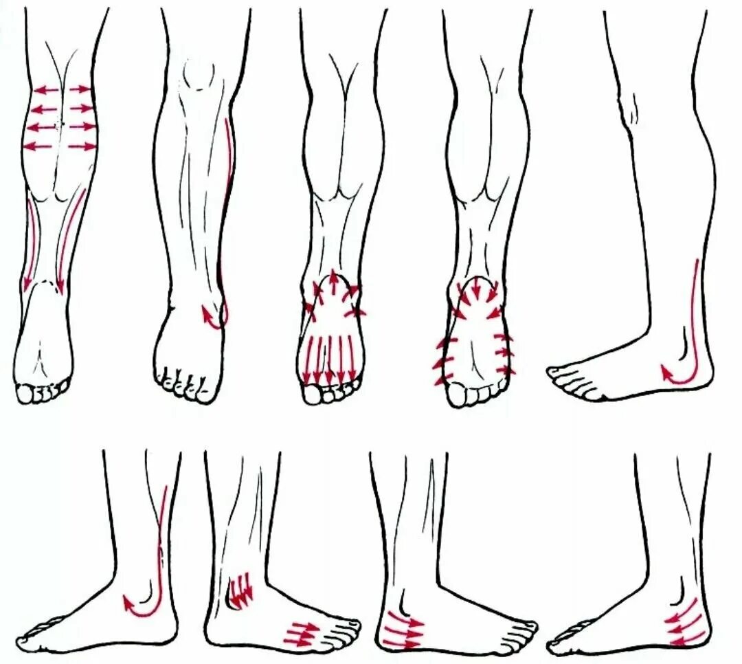 Массаж при полинейропатии нижних конечностей техника. Массаж ног при нейропатии нижних конечностей. Схема лимфодренажного массажа ног. Массаж Гуаша для стопы схема.