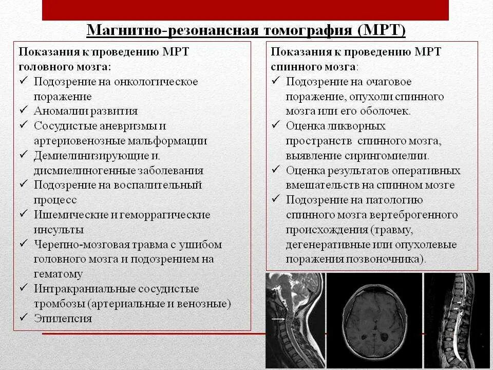 Чем отличается узи от мрт. Показания к мрт. Показания к проведению мрт. Показания к проведению кт. Показания для проведения компьютерной томографии.