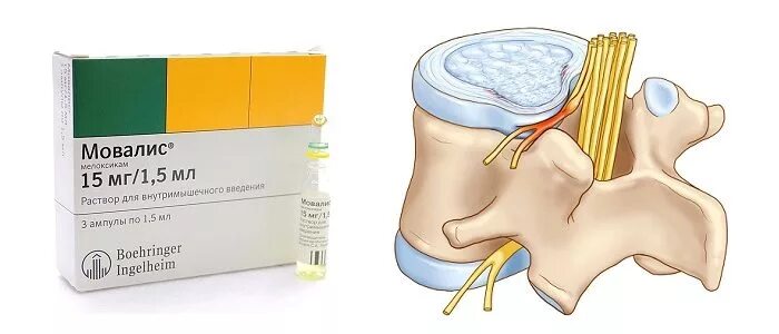 Обезболивающие при грыже пояснице. Обезболивающие при грыже позвоночника поясничного отдела уколы. Обезболивающие таблетки при болях в спине грыжа позвоночника. Препарат от грыжи позвоночника уколы. Уколы от межпозвоночной грыжи.