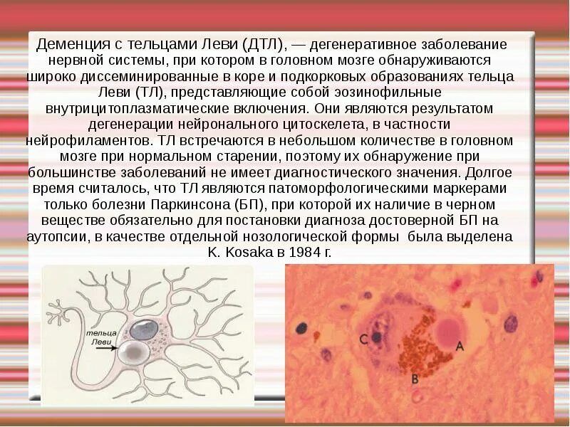 Патоморфология деменция с тельцами Леви. Тельца Леви гистология. Болезнь Альцгеймера патологическая анатомия. Патоморфология болезни Альцгеймера.