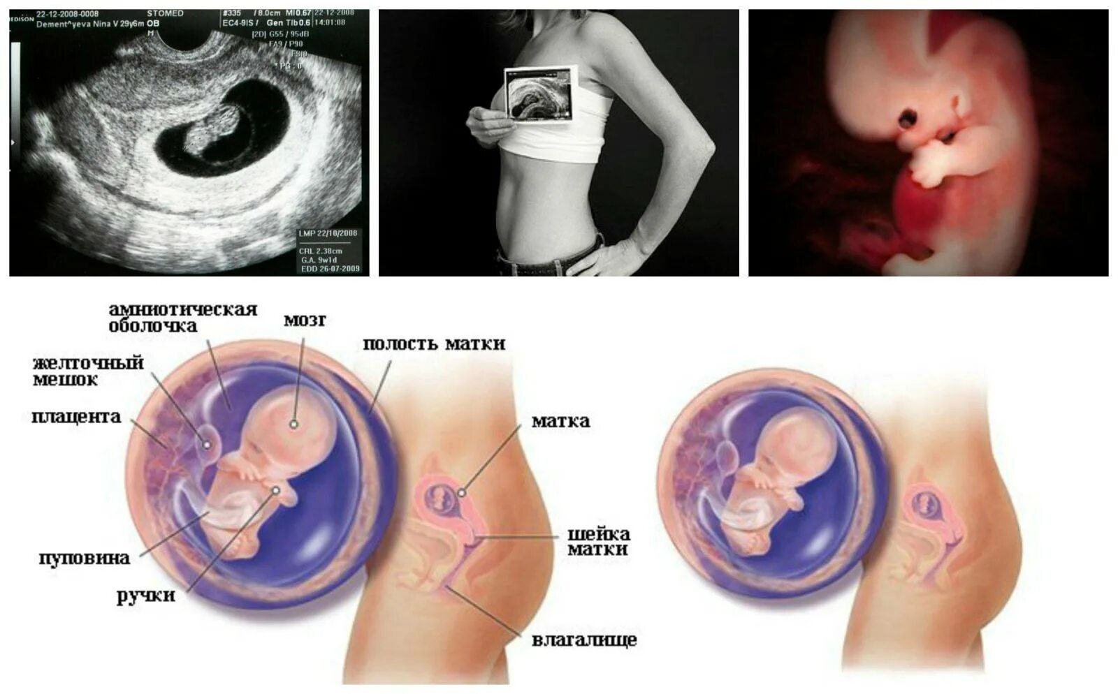 Эмбрион в 8-9 недель беременности. Плод ребенка на 8-9 неделе беременности. Как выглядит эмбрион ребёнка в 9 недель. 8-9 Недель беременности размер плода.