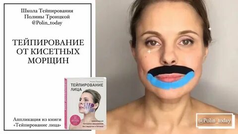 Тейпирование кисетных морщин