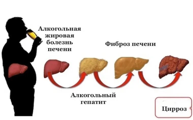 Сколько восстанавливается печень после отказа. Печень здоровая и больная. печень больная гепатитом.