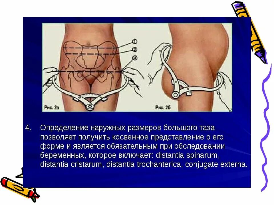 Что значит таз. Измерить наружные размеры таза алгоритм. измерение наружных размеров большого таза. измерение размеров таза беременной алгоритм. измерение наружных размеров большого таза алгоритм.