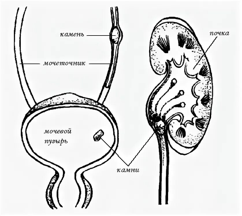 Операция мочевой пузырь собака. Мочекаменная болезнь Ветеринария. Мочекаменная болезнь у пушных зверей. Мочевыделительная система кошки анатомия. Этиология мочекаменной болезни у животных.