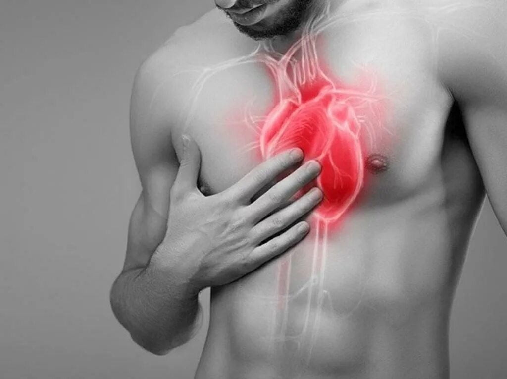 Боль в суставах. Болит спина. Иррадиация боли при инфаркте миокарда. Локализация сердечных болей. Локация боли.