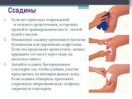 Обработка раны при оказании первой