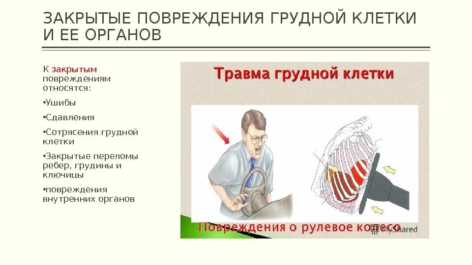 Признаки открытого повреждения грудной клетки. Травматические повреждения грудной клетки симптомы. Клинические симптомы ушиба грудной клетки. Признаки повреждения перелом грудной клетки.