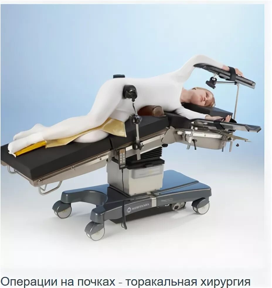 Положение больного на столе. Стол операционный practico. Операционный стол UFSK xle500 со столиками. Пациент на операционном столе. Положение пациента на боку на операционном столе.