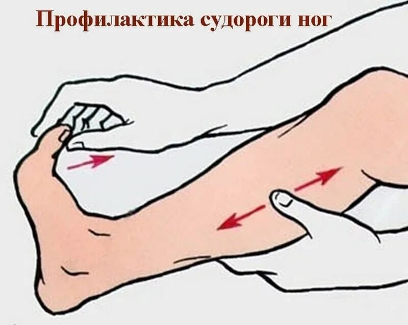 Судорога что делать первая помощь. Судороги первая помощь. 1 помощь при судорогах в ногах. Судорожный синдром первая помощь доврачебная. Первая помощь пр судорог ах.