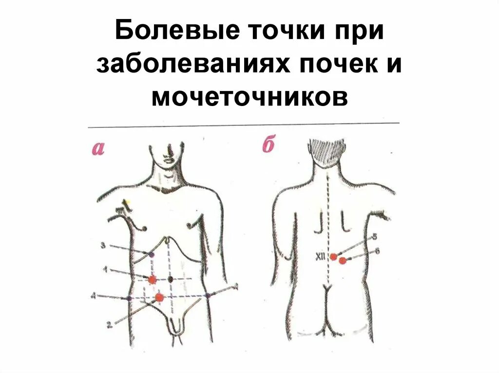 Точка спереди. Мочеточниковые точки. Точки при болезни почек. Болевые точки при почках.