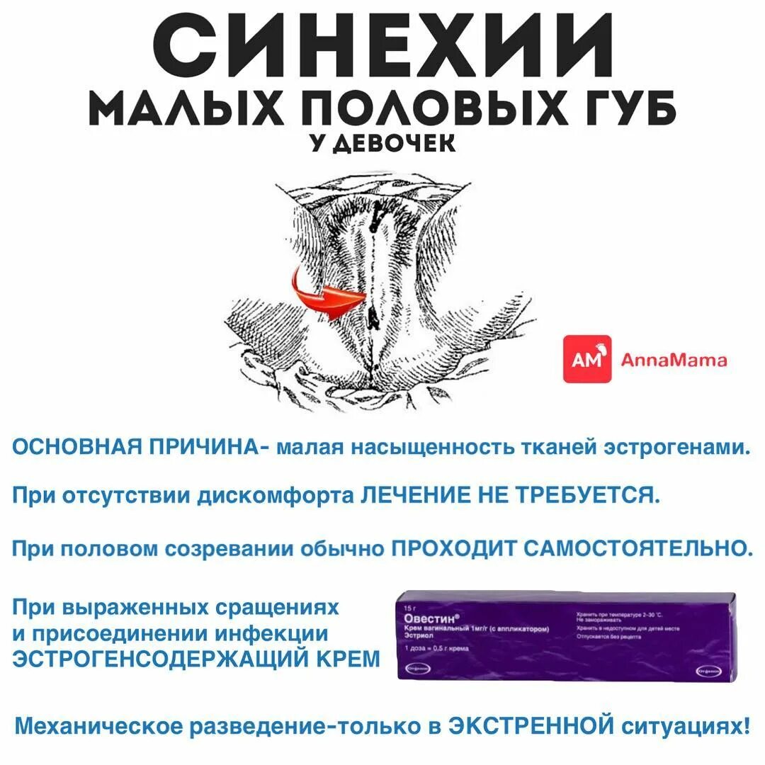 Синехии причины возникновения. Сращение малых половых губ у ребенка. Сращение малых губ у ребенка. Острое воспалительное заболевание внутренних половых органов:. Синехии у девочек овестин.