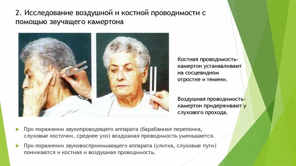 Проба камертонами. Исследование костной проводимости. исследование костной и воздушной проводимости. определение костной и воздушной проводимости звука. исследование воздушной проводимости камертонами.