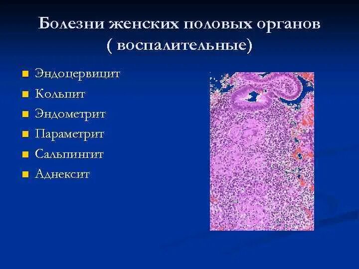 Специфические заболевания женских органов. Заболевания половых органов. Заболевания женских органов. Болезни женских половых органов. Воспалительные заболевания женских половых органов названия.