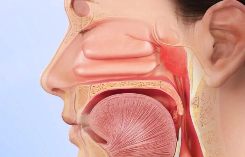 Лор органы у детей. Анатомия ЛОР органов аденоиды. Аденоиды носоглотки нос.