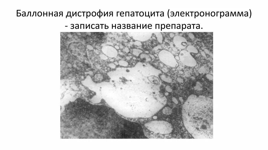 Исследование дистрофии