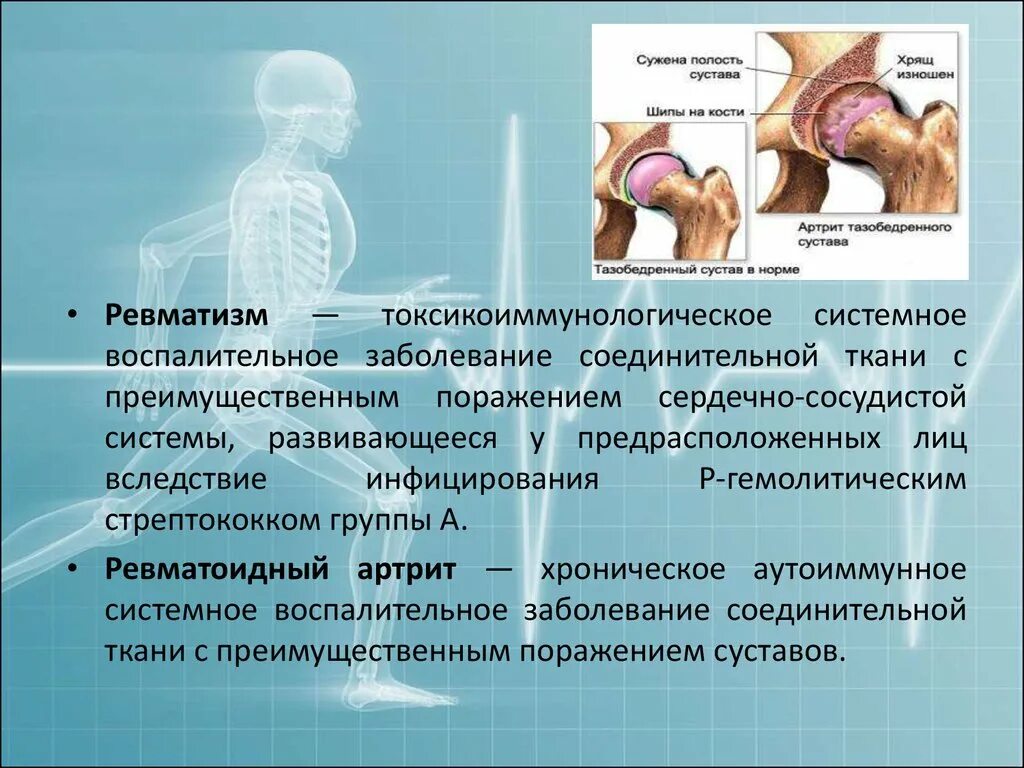 Воспаление суставов заболевание. Ревматизм это системное заболевание. Ревматизм системные заболевания соединительной ткани.