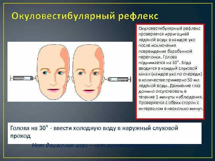 Окуловестибулярный рефлекс. Вестибуло-окулярные рефлексы. Вестибуло окулрный рефлекс. Вестибулоокулярный рефлекс нистагм.