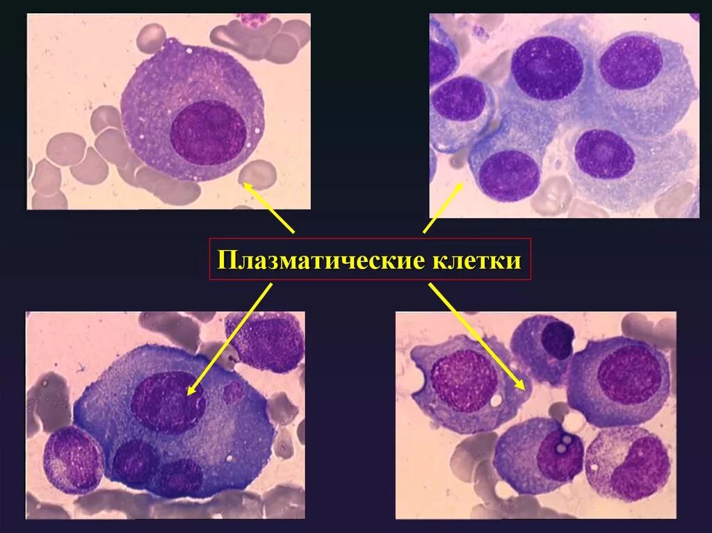Плазматические клетки 5