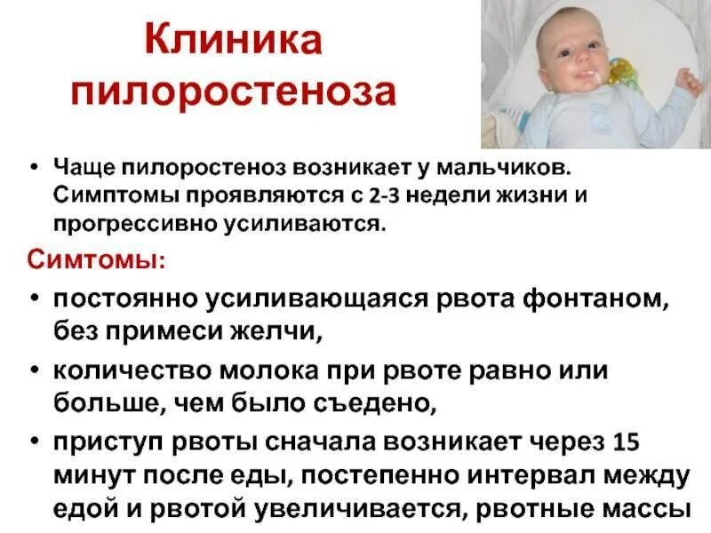 Срыгивание у новорожденных. Пилоростеноз у детей клиника. Причины срыгивания у новорожденных детей. Признаки пилоростеноза у детей. Срыгивает через 2 часа после кормления