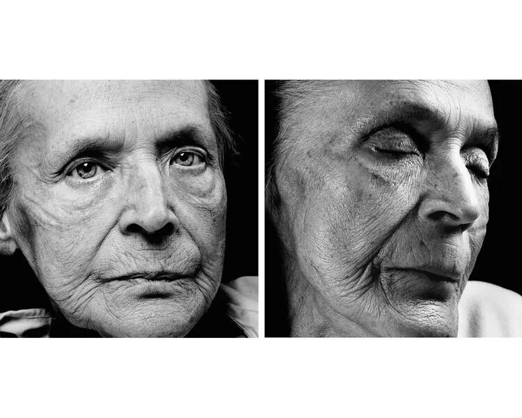 Классический прямой нос. Эмоции слепых людей. У человека заостряется нос. Пластика носа. У человека заостряется нос.