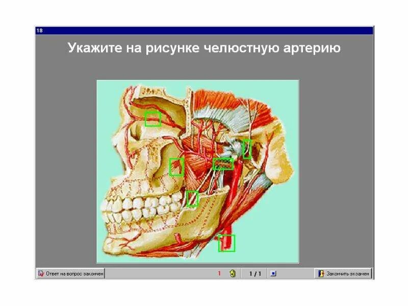 Ушно-височный нерв иннервация. Ушно-височный нерв анатомия. Тройничный нерв ушновисочный нерв. Ушно височный нерв ветвь.