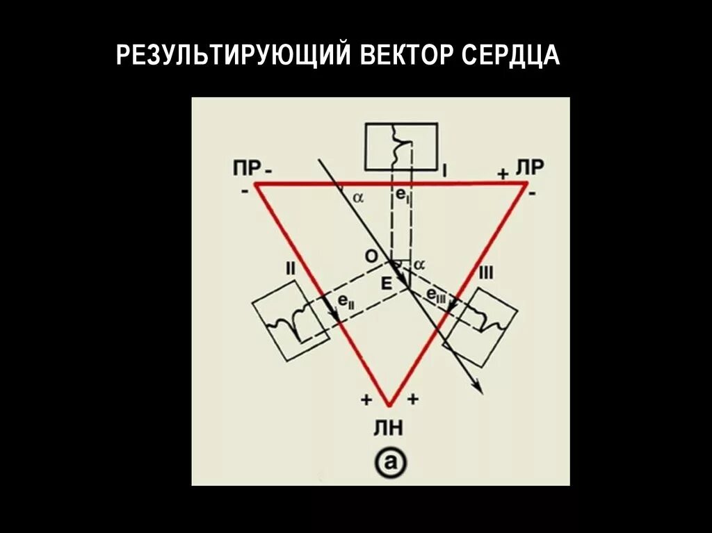 Как направлен результирующий вектор. Результирующий вектор. треугольник эйнтховена. результатирущий вектор. результирующий вектор сердца.