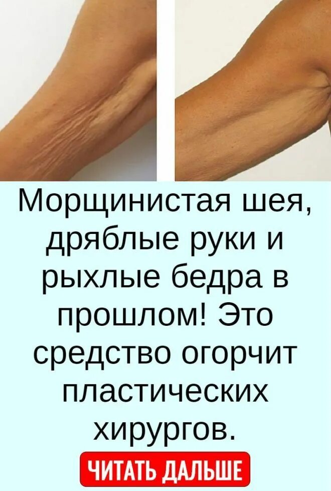 Как убрать дряблость рук. Как подтянуть руки обвисшие. Как убрать дряблость рук. Массаж рук от обвислости. Как убрать дряблость рук.