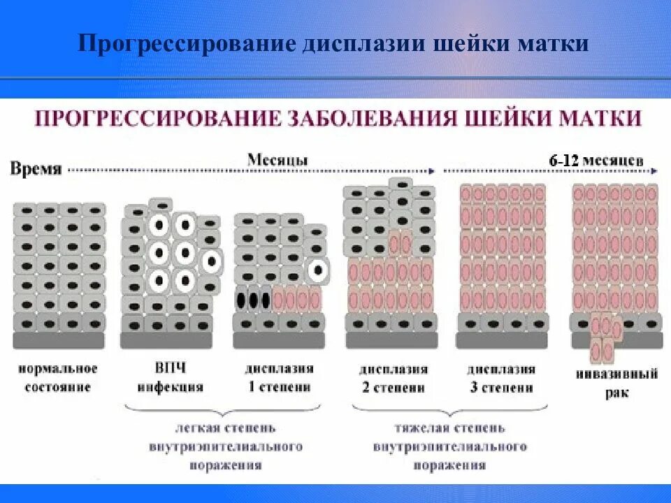 Лекарства при дисплазии шейки. Дисплазия 3 степени лечение прогноз. Дисплазия 3 степени лечение прогноз. Дисплазия шейки матки степени. Дисплазия 3 степени лечение прогноз.