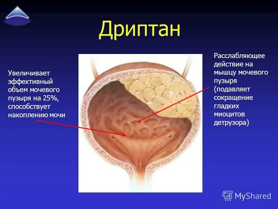 Расслабленный мочевой пузырь