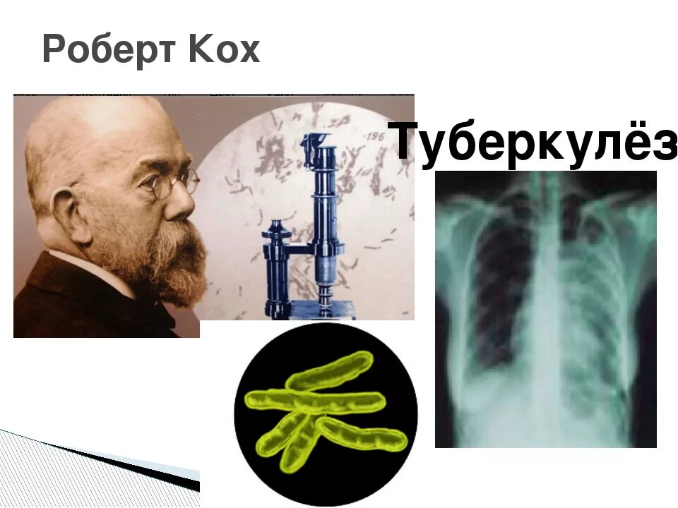 Кох р открытие туберкулезной палочки наука. Кох р открытие туберкулезной палочки наука. Палочка коха возбудитель туберкулеза. Кох р открытие туберкулезной палочки наука. Кох р открытие туберкулезной палочки наука.