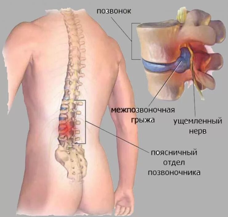 Сколиоз позвоночника рентген рёбра. Болезнь бехтерева шейного отдела позвоночника. 5 позвоночник симптомы. Пояснично-крестцовый отдел фото. Протрузии грудного отдела позвоночника.