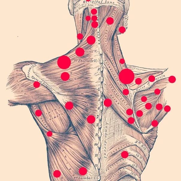 Карта триггерных точек человека. Триггерные точки при межреберной невралгии. Клинический атлас триггерных точек | бил эндрю. Триггерные точки книга. Триггерные точки на спине грудной отдел.