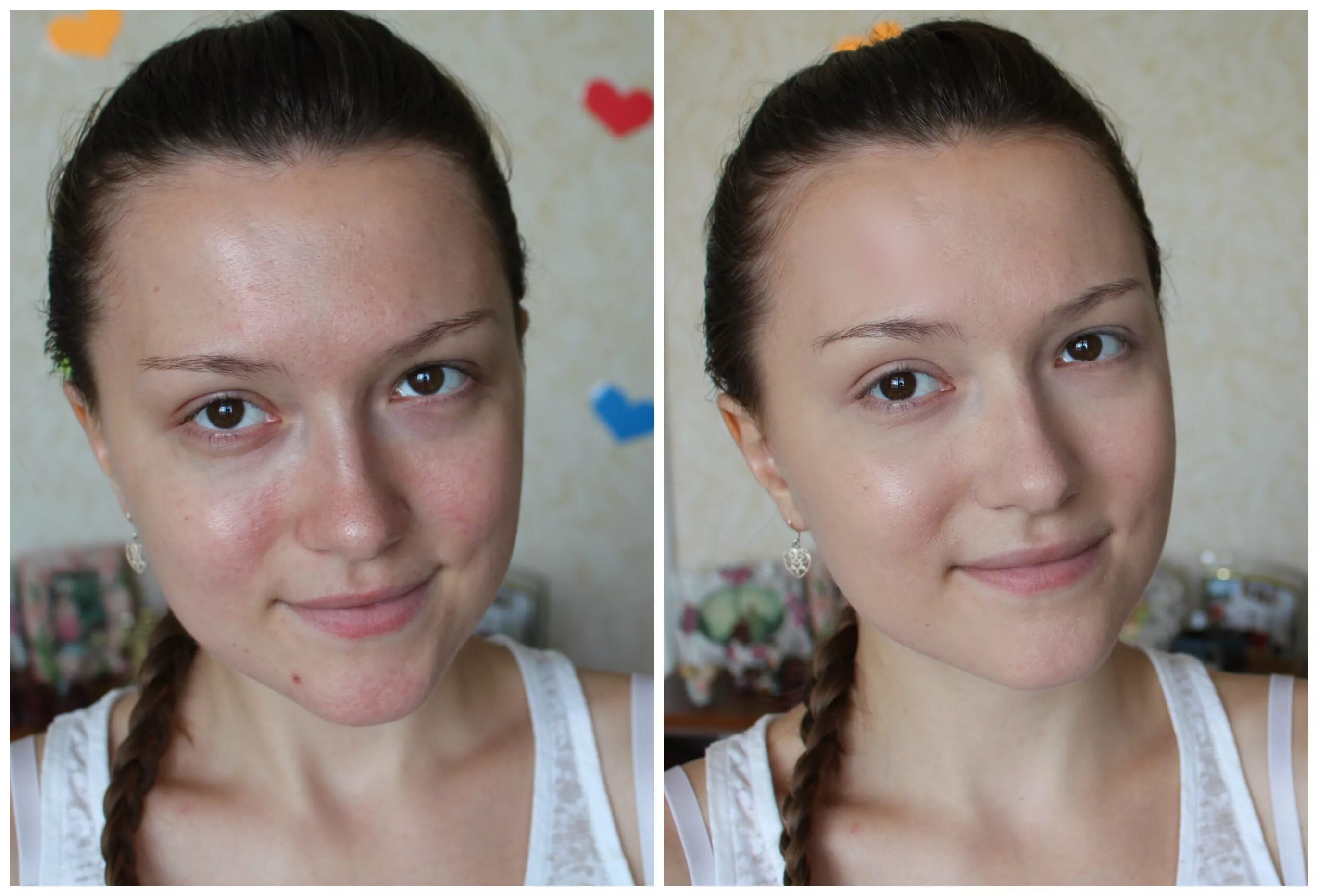 Идеальная кожа. Красивая кожа. Как сделать лицо чистым и гладким. Как сделать лицо чистым и гладким. Красивое ровное лицо.