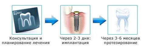 Имплантация сколько болит