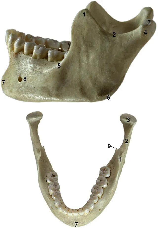 Кость челюсти. Нижняя челюсть. Кости нижней челюсти человека. Нижняя челюсть с другими костями черепа