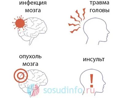 Инфекции мозга симптомы