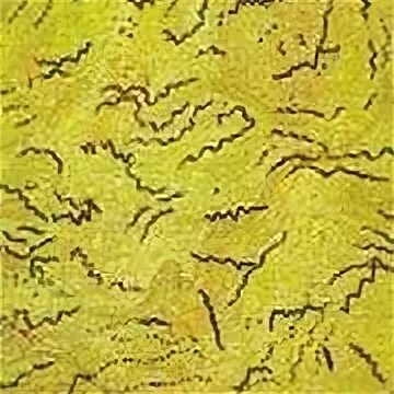 Серебрение по морозову трепонема. По морозову. Окраска по морозову микробиология. Окраска по морозову бактерии. Бледная трепонема романовский гимзе.