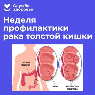 Отзывы рака кишечника форум отзывы
