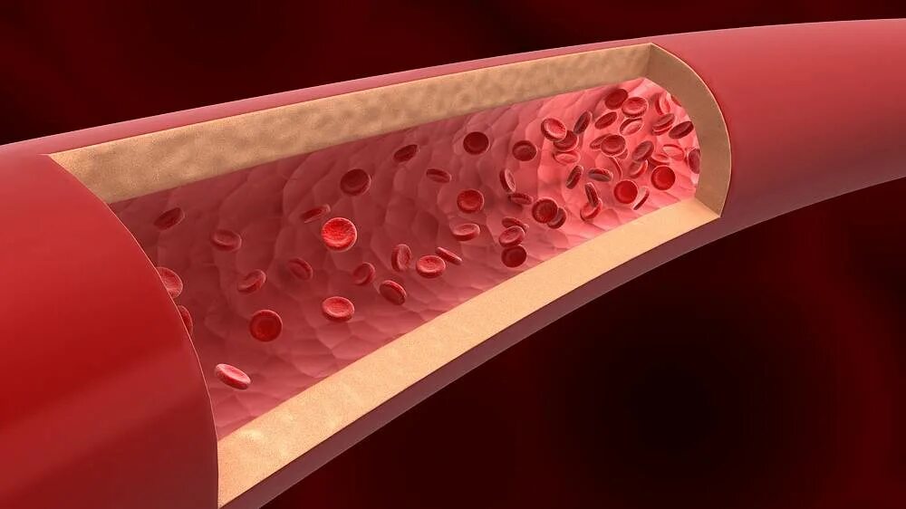 Разрыв кровеносного сосуда. Сосудистая стенка эндотелий. Эпителий сосудов эндотелий. Эндотелиальный микроскоп em-3000. Кровеносный сосуд изнутри.