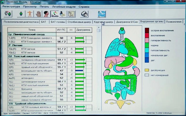 мочеотводной катетер. схема аппарата по методу фолля. метод фоли. резонансно-частотная терапия метод фолля. метод фоли.