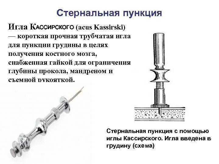 Как берут пункцию мозга. Игла Кассирского для стернальной пункции. Техника проведения стерильной пункции. Стернальная пункция методика. Подготовка пациента к стернальной пункции при лейкозе.