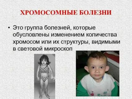 Нарушения числа хромосом