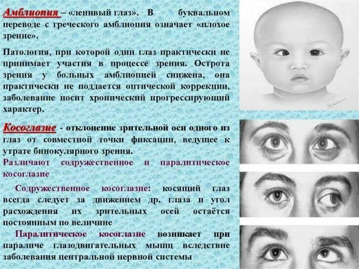 Можно вылечить амблиопию