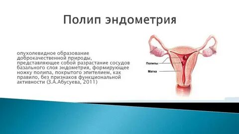После удаления полипа эндометрия через сколько