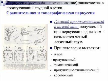 Что такое перкуссия