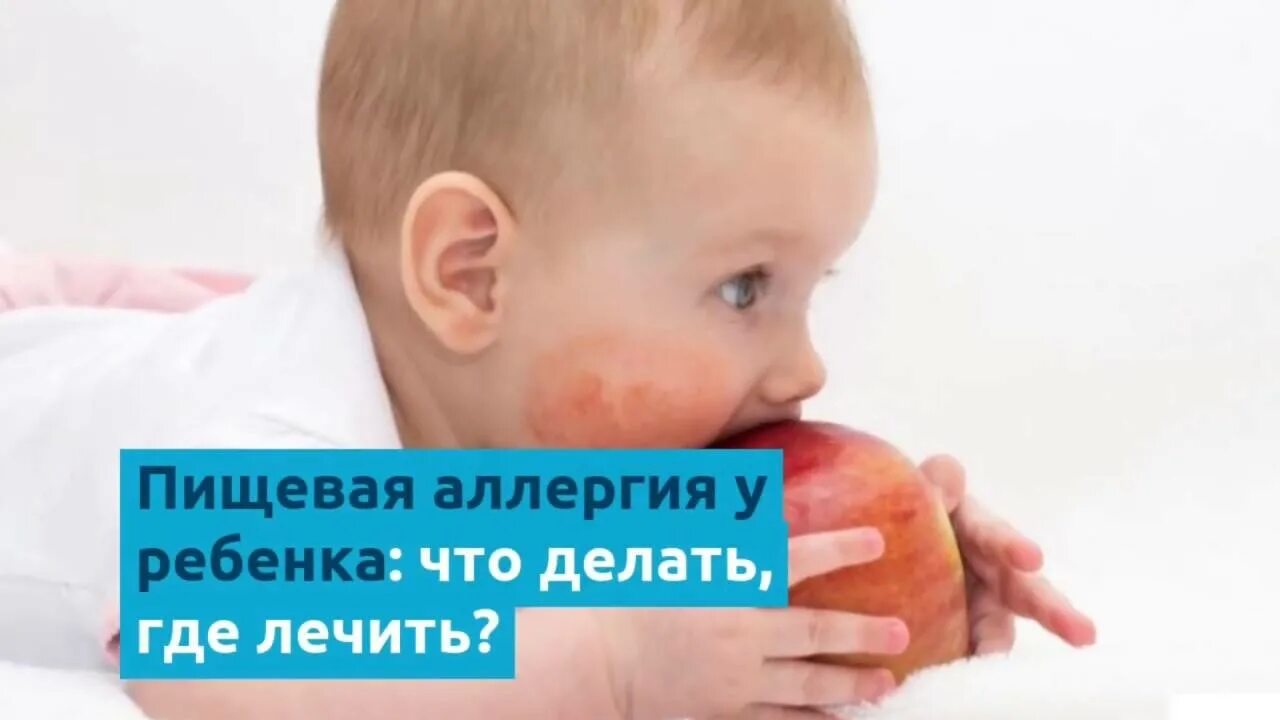 4 ребенка реакция. аллергический дерматит у новорожденных. гнейс атопический дерматит. 4 ребенка реакция. пищевая аллергия у младенца.