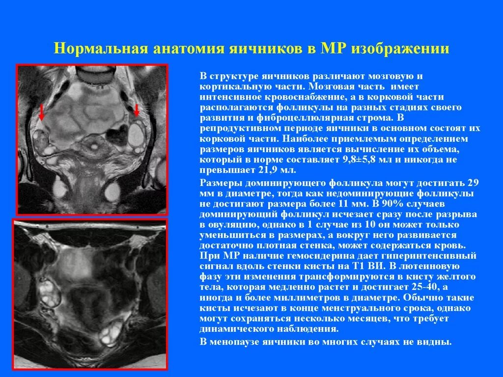 Размер матки и яичников. Нормальная анатомия яичников.