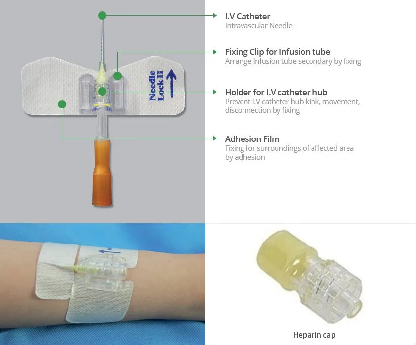 канюля внутривенная softcathe 22g. гепарином катетер. гепаринизированный катетер. (picc-катетеры/пик-катетеры). 5 мл.
